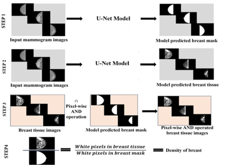 Segmentation of Breast Tissues and Classification of Breast Based on ...